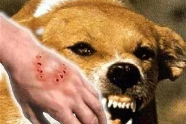 梦见狗咬自己的手