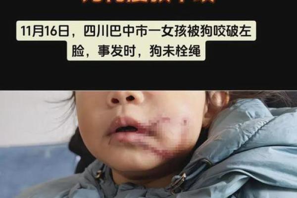 女人做梦狗咬了是什么意思