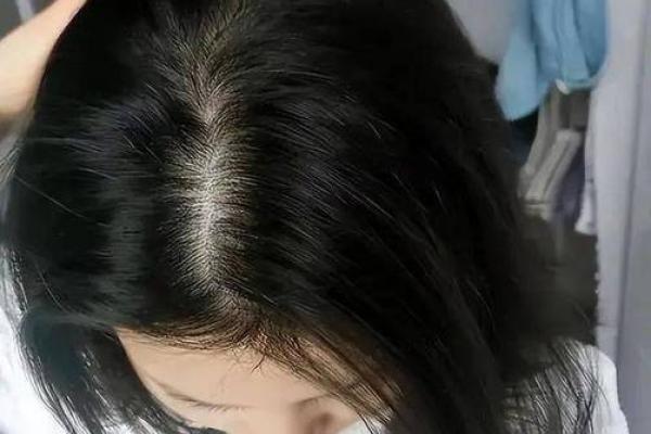 初几不能洗头发