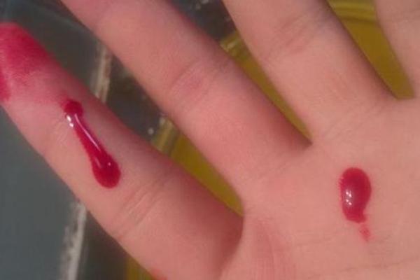 梦到血是什么预兆男人 梦到血是什么预兆男人