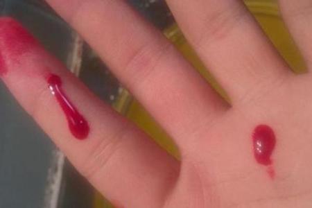 梦到血是什么预兆男人