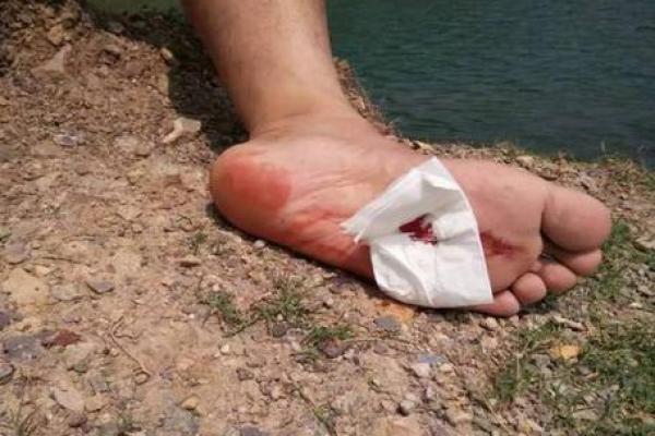 梦见砍人出血是什么预兆解梦 梦见砍人出血是什么预兆解梦