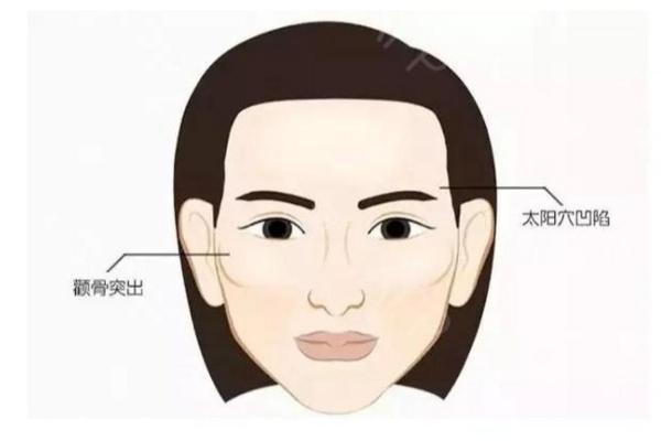 颧骨高的女人克夫吗 颧骨高的女人克夫吗